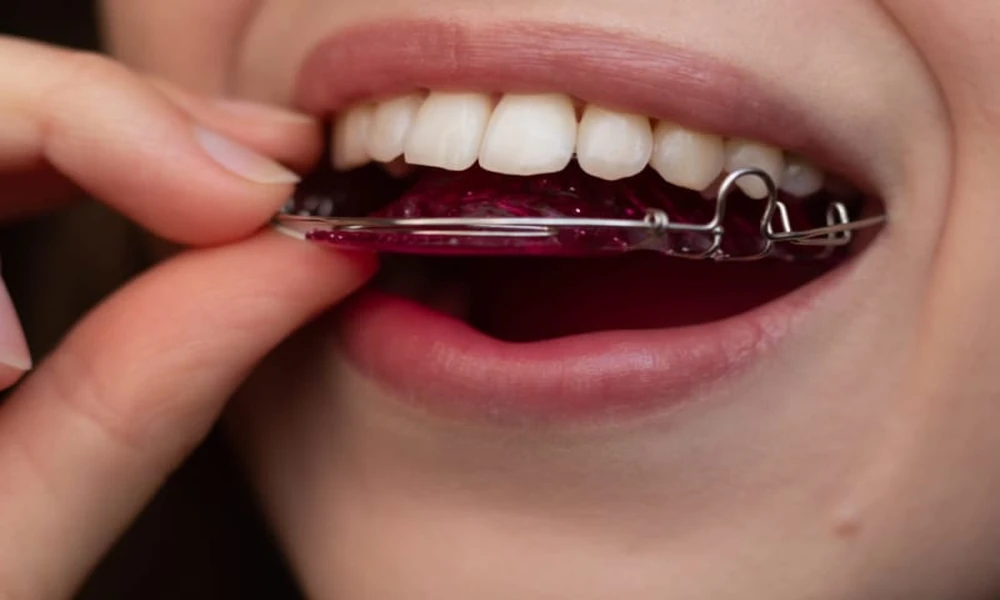 Why Teeth Shift After Braces: The Biology Of Relapse