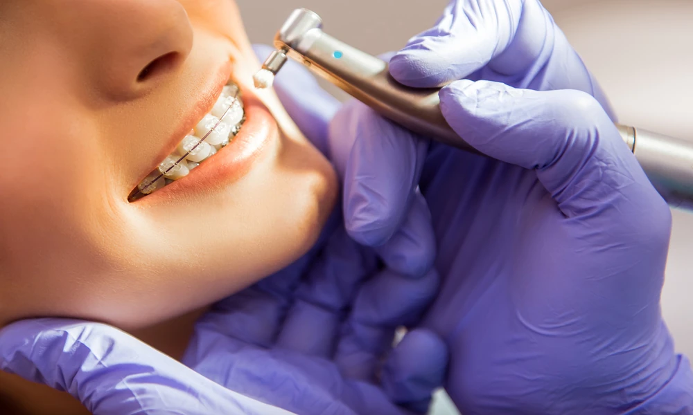4 Benefits Of Starting Orthodontics At A Family Dental Practice